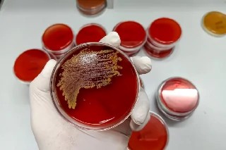 imagem Básico em Bacteriologia Clínica