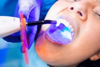 imagem Básico em Resina Composta na Odontologia