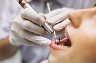 imagem Odontologia no Tratamento de Pacientes com Dependência Química